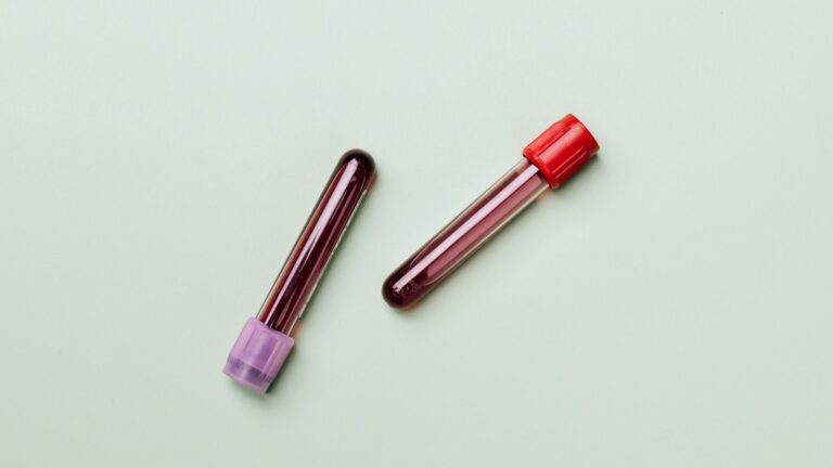 Blood sample test tubes in medical research laboratory