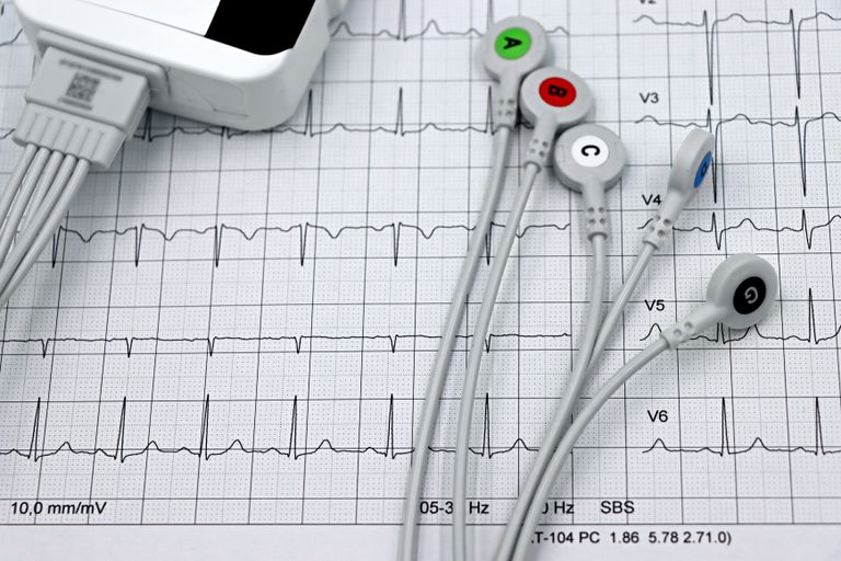 ECG leads on a printed cardiogram.